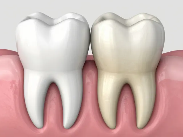 Implantát po vytržení zubu: Kdy je nejlepší načasovat zákrok?